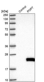 POP7 Antibody in Western Blot (WB)