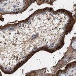 HSD17B1 Antibody in Immunohistochemistry (Paraffin) (IHC (P))