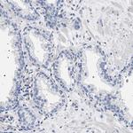 HSD17B1 Antibody in Immunohistochemistry (IHC)