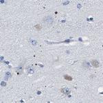 HSD17B1 Antibody in Immunohistochemistry (IHC)