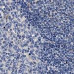 HSD17B1 Antibody in Immunohistochemistry (IHC)