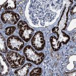 ALDH1B1 Antibody in Immunohistochemistry (Paraffin) (IHC (P))