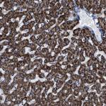 ALDH1B1 Antibody in Immunohistochemistry (Paraffin) (IHC (P))