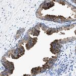 UBR4 Antibody in Immunohistochemistry (Paraffin) (IHC (P))