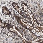 SCYL2 Antibody in Immunohistochemistry (Paraffin) (IHC (P))