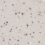 NOP58 Antibody in Immunohistochemistry (Paraffin) (IHC (P))