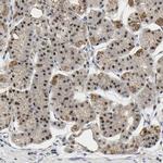 NOP58 Antibody in Immunohistochemistry (Paraffin) (IHC (P))