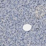 GTPBP10 Antibody in Immunohistochemistry (Paraffin) (IHC (P))