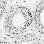 GTPBP10 Antibody in Immunohistochemistry (Paraffin) (IHC (P))