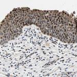 GTPBP10 Antibody in Immunohistochemistry (IHC)