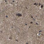 MYO18A Antibody in Immunohistochemistry (IHC)