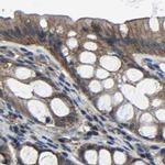 MYO18A Antibody in Immunohistochemistry (IHC)