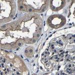 MYO18A Antibody in Immunohistochemistry (IHC)