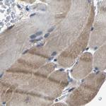 MYO18A Antibody in Immunohistochemistry (IHC)