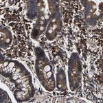 ITCH Antibody in Immunohistochemistry (IHC)