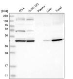 KBTBD2 Antibody in Western Blot (WB)