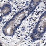 KLHL41 Antibody in Immunohistochemistry (IHC)