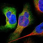 CCBL1 Antibody in Immunocytochemistry (ICC/IF)