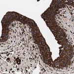 CCBL1 Antibody in Immunohistochemistry (Paraffin) (IHC (P))