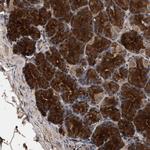 CCBL1 Antibody in Immunohistochemistry (Paraffin) (IHC (P))