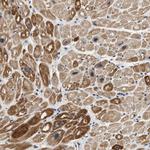 OBSCN Antibody in Immunohistochemistry (Paraffin) (IHC (P))