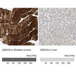 OBSCN Antibody in Immunohistochemistry (IHC)