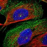 CROCC Antibody in Immunocytochemistry (ICC/IF)