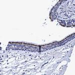 CROCC Antibody in Immunohistochemistry (Paraffin) (IHC (P))