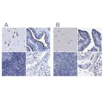 CROCC Antibody in Immunohistochemistry (IHC)