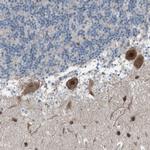 ZNF276 Antibody in Immunohistochemistry (Paraffin) (IHC (P))