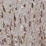 WDR60 Antibody in Immunohistochemistry (Paraffin) (IHC (P))