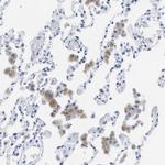 LRWD1 Antibody in Immunohistochemistry (Paraffin) (IHC (P))