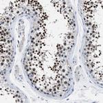 LRWD1 Antibody in Immunohistochemistry (Paraffin) (IHC (P))