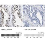 LRWD1 Antibody in Immunohistochemistry (IHC)