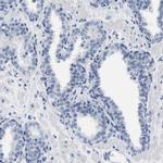 LRWD1 Antibody in Immunohistochemistry (IHC)