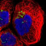 GCC1 Antibody in Immunocytochemistry (ICC/IF)