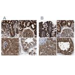 GCC1 Antibody in Immunohistochemistry (IHC)