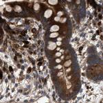 GCC1 Antibody in Immunohistochemistry (IHC)