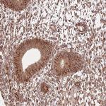 ADAMTS3 Antibody in Immunohistochemistry (Paraffin) (IHC (P))