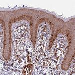 ADAMTS3 Antibody in Immunohistochemistry (Paraffin) (IHC (P))