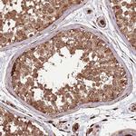 ADAMTS3 Antibody in Immunohistochemistry (Paraffin) (IHC (P))