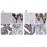 MKS1 Antibody in Immunohistochemistry (IHC)