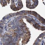 MKS1 Antibody in Immunohistochemistry (IHC)