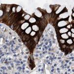 MKS1 Antibody in Immunohistochemistry (IHC)