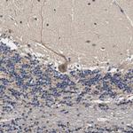 ZADH2 Antibody in Immunohistochemistry (Paraffin) (IHC (P))