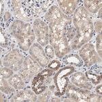 ZADH2 Antibody in Immunohistochemistry (Paraffin) (IHC (P))