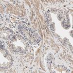 ZADH2 Antibody in Immunohistochemistry (Paraffin) (IHC (P))