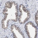 GMPR Antibody in Immunohistochemistry (IHC)