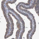 GMPR Antibody in Immunohistochemistry (IHC)