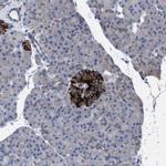 GMPR Antibody in Immunohistochemistry (IHC)